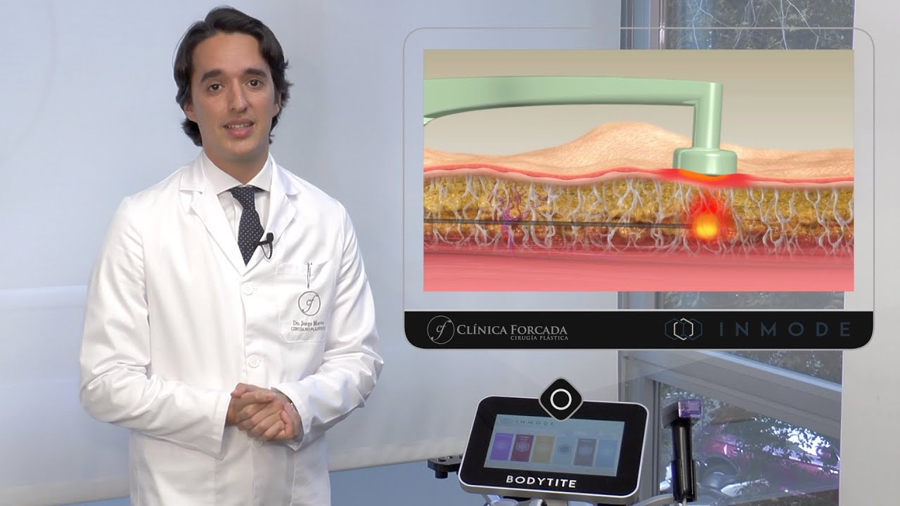 Eduardo Forcada Melero-23