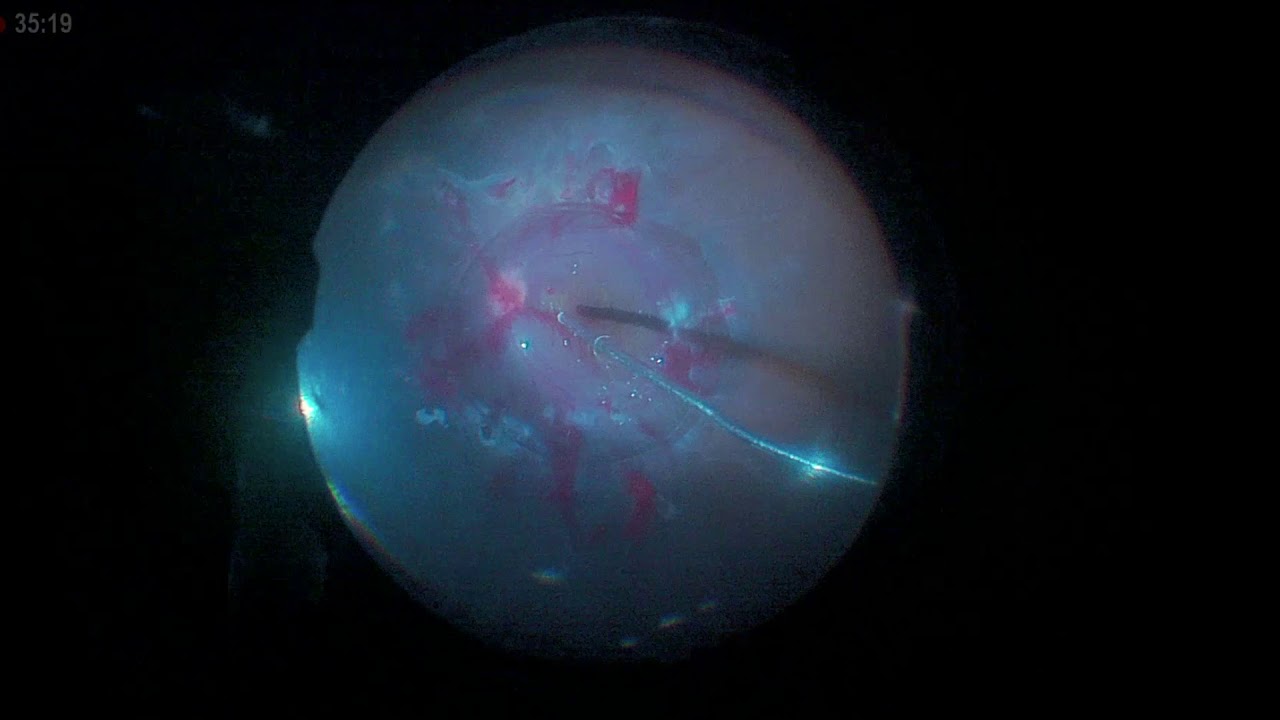 Marco Antonio Rayón Rodríguez-13