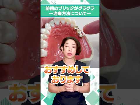 前歯のブリッジがグラグラ 〜治療方法について ドイツ式入れ歯も選択肢！〜