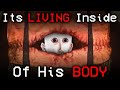 The PARASITE Torturing Him From The INSIDE Doctor Nowhere