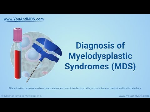 Diagnosis of Myelodysplastic Syndromes (MDS)