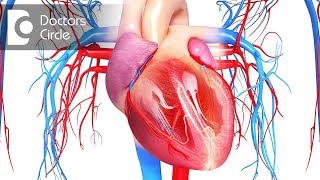 Does recurrennce of fluid post pericardial surgery possible? - Dr. Durgaprasad Reddy B