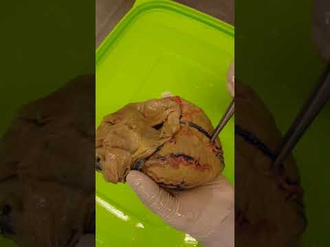 Anatomia de corazon 02