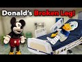 DonaldDucc Donald S Broken Leg