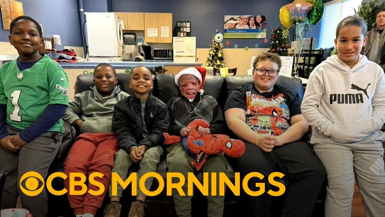 School rallies around boy severely burned after jet crashed near car: "Strongest person I know"