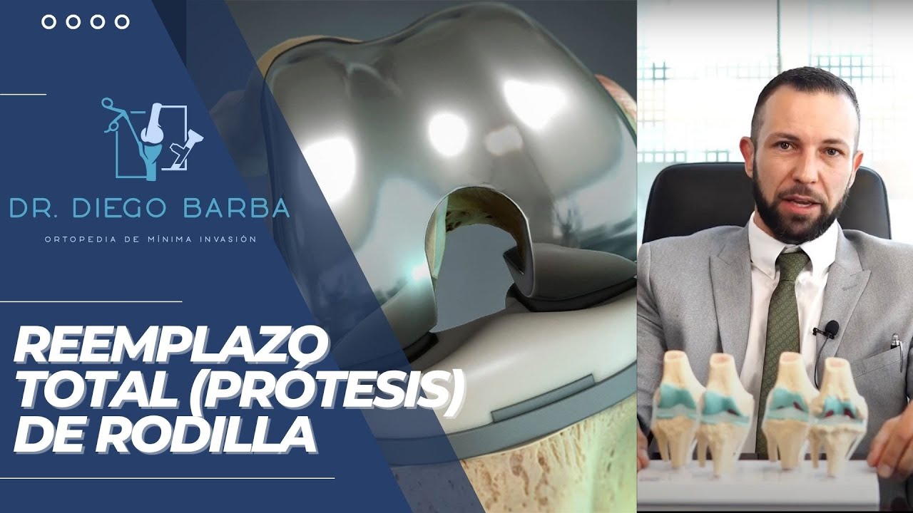 Diego A Barba Gutiérrez-11