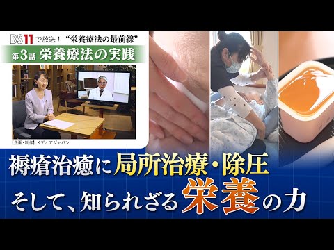 栄養学科 BS11放送番組・第３話【栄養療法の実践】褥瘡治癒に局所治療・除圧、そして知られざる栄養の力