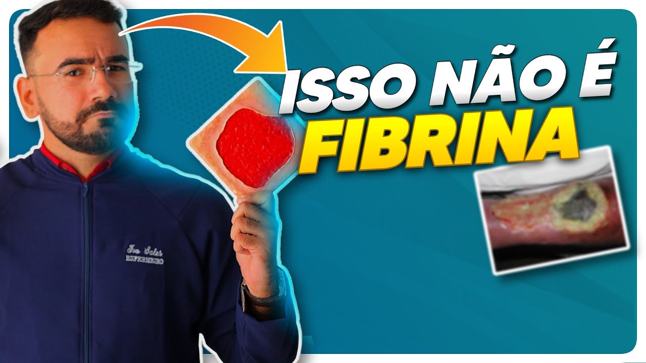 ISTO NÃO É FIBRINA! APRENDA AGORA FERIDAS E CURATIVOS DO JEITO CERTO!