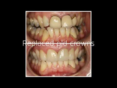 Dr Julie Flor Cordeta's Cases