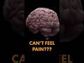 This is the REAL reason headaches hurt