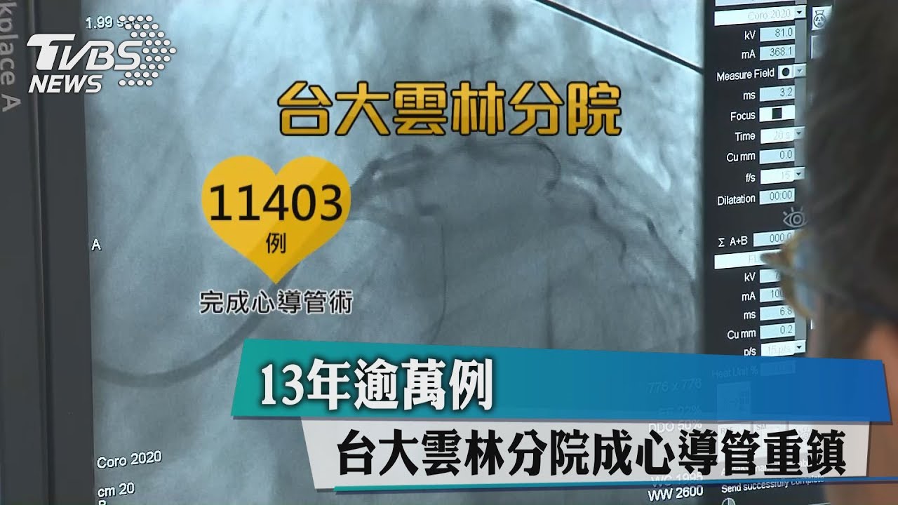 13年逾萬例 台大雲林分院成心導管重鎮