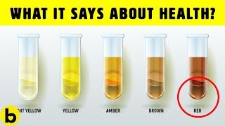 What The Color Of Your Urine Says About Your Health