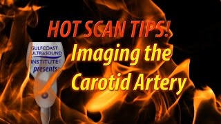 Hot Tip - Imaging The Carotid Artery