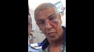 Подробности о состоянии избитого в Москве известного актера