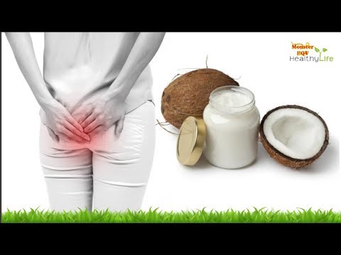 How to Get Rid of Hemorrhoids (Piles) Naturally