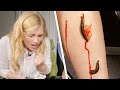 Leeches Suck Maddie’s Blood! Time-Lapse | Earth Unplugged Leeches Suck Maddie’s Blood! Time-Lapse | Earth Unplugged