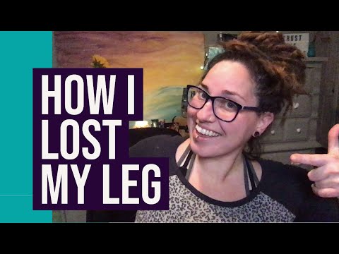 How I Lost My Leg | PFFD