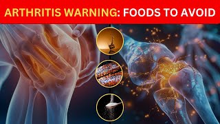Arthritis! Warning, (NEVER Eat These 7 Foods😱)  Vitality Beyond 50