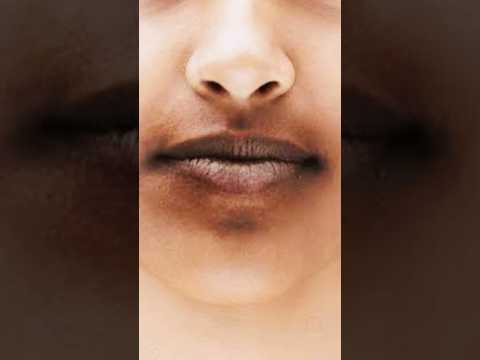 होठों के आस पास कालापन क्यों आता है ?कारण और उपाय?Why does darkness appear around the lips?