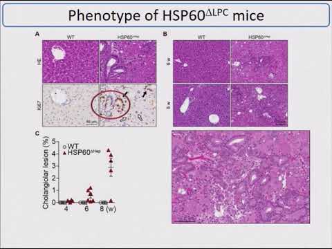 2018 Cholangiocarcinoma Foundation Annual Conference #21 - Day 2 - Mitochondrial Dysfunction