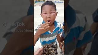 Download lagu LOL! BOY SEEKS REVENGE AFTER BEING Stung by a BEE mp3