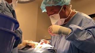 Rhinoplasty with Septal Harvest | Beverly Hills | Dr. Gabriel Chiu