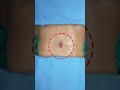 Umbilicoplasty Surgery Belly Button Surgery Shorts