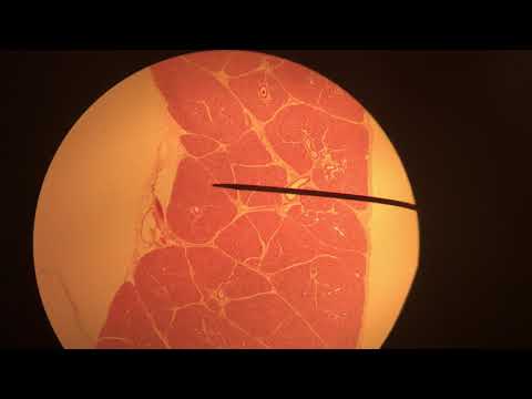 Parotid salivary gland slide 40X