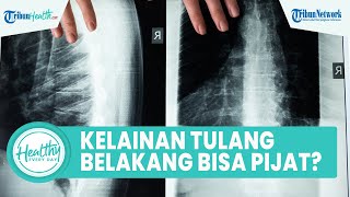 Bolehkah Penderita Kelainan Tulang Belakang Melakukan Pijat?, Begini Penjelasan dr.Nilla Mayasari