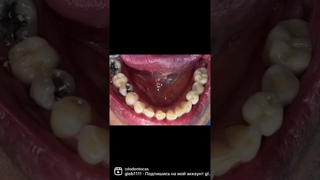 Ricardo Casados Lugo-23