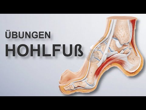 Hohlfuß | 4 Übungen für zuhause