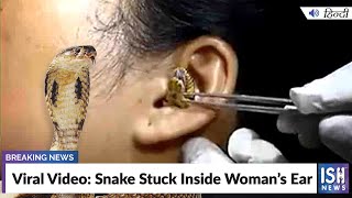 Viral Video: Snake Stuck Inside Woman’s Ear