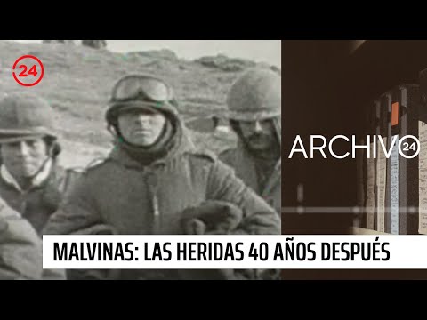 Archivo 24: Malvinas, las heridas de la guerra 40 años después | 24 Horas TVN Chile