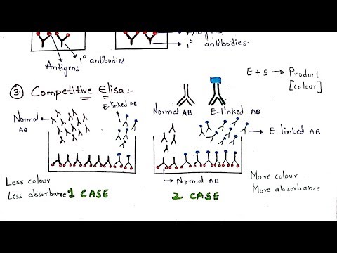 Radial immunodiffusion Immunotechnology Bio science