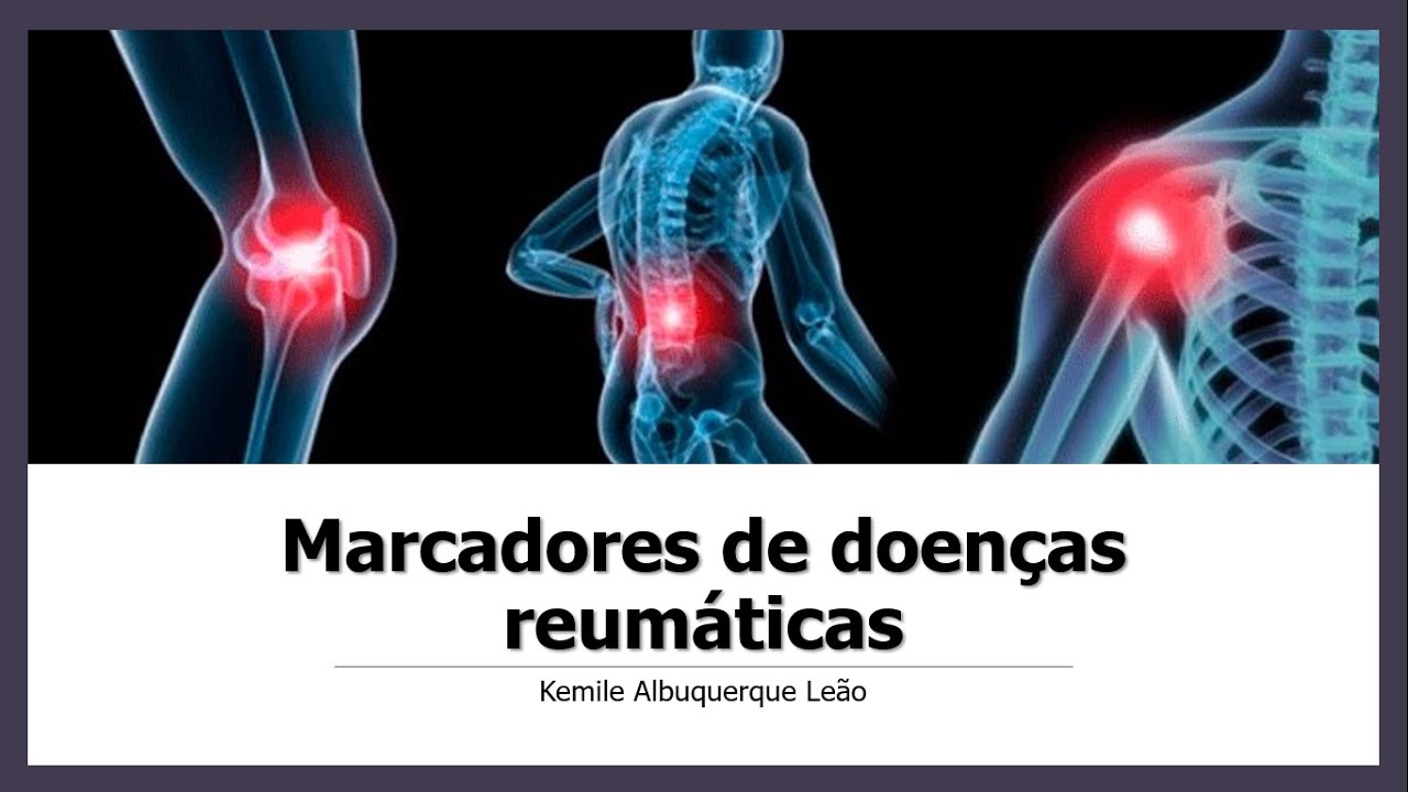 Marcadores de doenças reumáticas