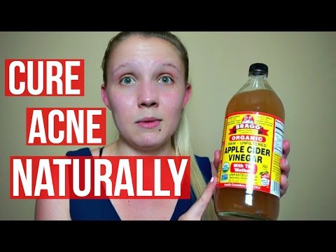CURE ACNE NATURALLY WITH APPLE CIDER VINEGAR│Danielle Ruppert Video