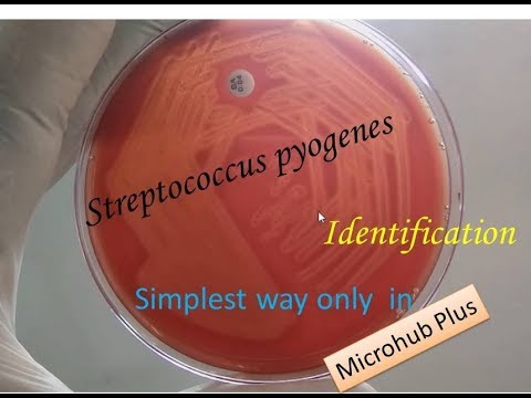 How do you identify S pyogenes?