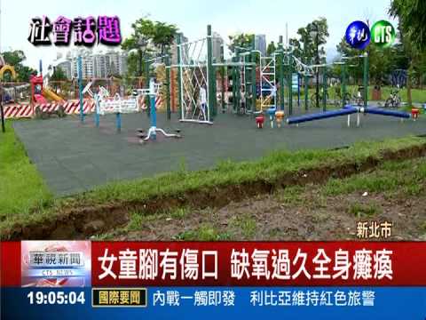 公園赤腳被電昏 女童昏迷癱瘓