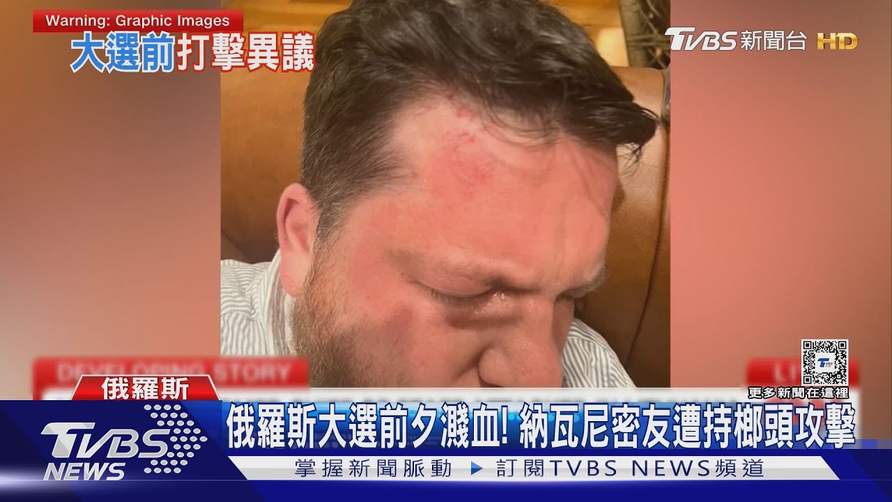 俄羅斯大選前夕濺血!納瓦尼密友遭持榔頭攻擊