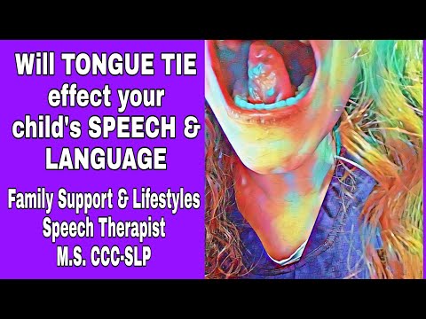 How does Tongue Tie effect Speech Development & Swallowing Function- Early Signs of Tongue Tie