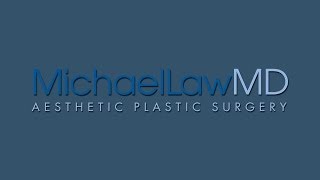 preview picture of video 'Chin Liposuction - Michael Law, MD - Raleigh, NC'