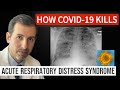 How Coronavirus Kills Acute Respiratory