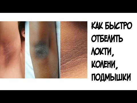 Купить отбеливающий крем для интимных зон в екатеринбурге Фото голая девушка в веснушках
