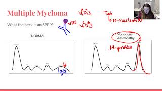 The Immunology Behind RMD 569  A re cap
