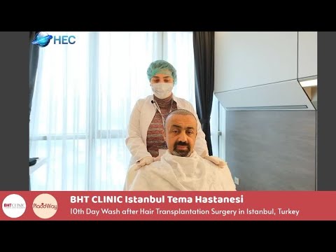 10th Day Wash after Hair Restoration in Istanbul, Turkey