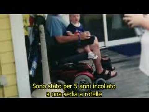 Quanto la chirurgia del cancro della prostata Podmore api BPH