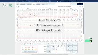 Denti.AI Voice - Dentrix Ascend Demo