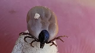 How to remove ticks from animals.