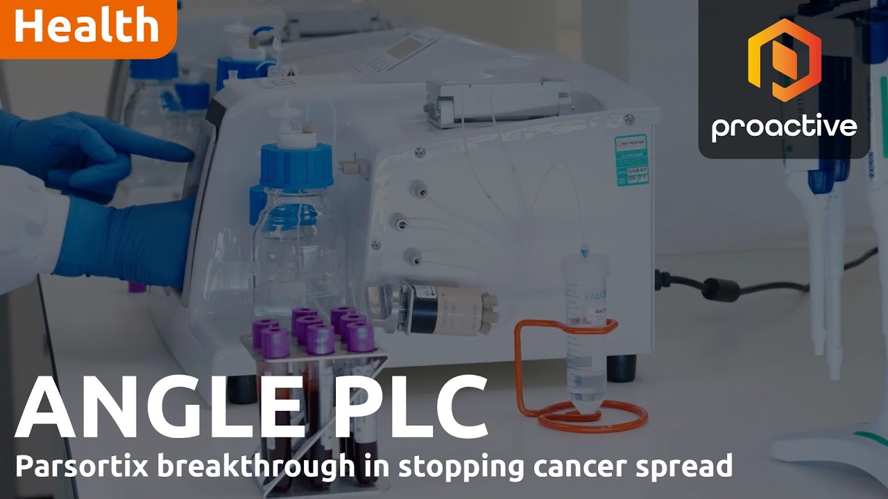 ANGLE PLC says Nature Medicine journal highlights Parsortix's role in cancer breakthrough