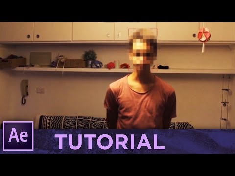 La crema da pigmentary nota la gravidanza Autore di lentiggini e musica